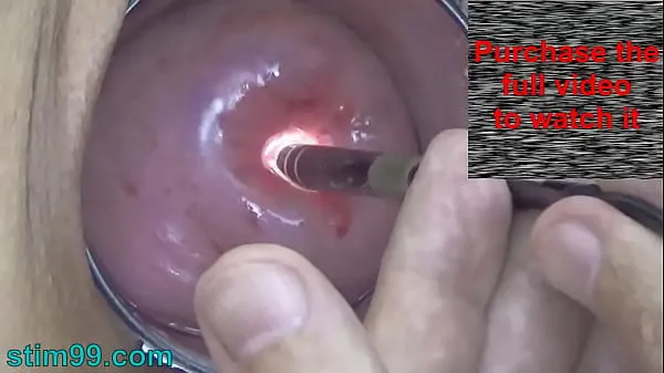 Hot Endoscope Camera inside Cervix Cam into Pussy Uterus totalt rör