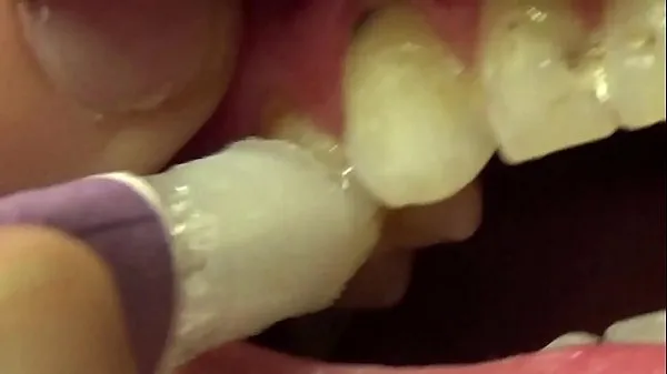 Hot Applying Whitening Paste To Her Filthy Teeth total Tube